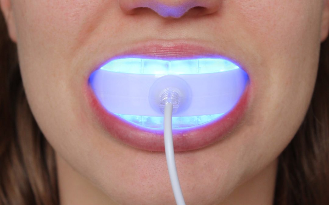 checkout these teeth whitening kits
